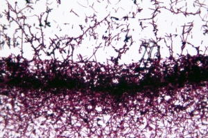 Actualización en Clostridium difficile  