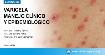 Varicela: manejo clínico y epidemiológico