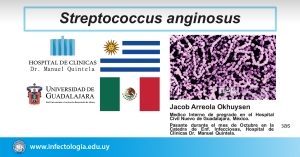 Streptococcus anginosus