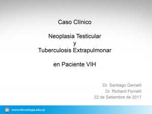 Neoplasia Testicular y Tuberculosis Extrapulmonar en Paciente VIH