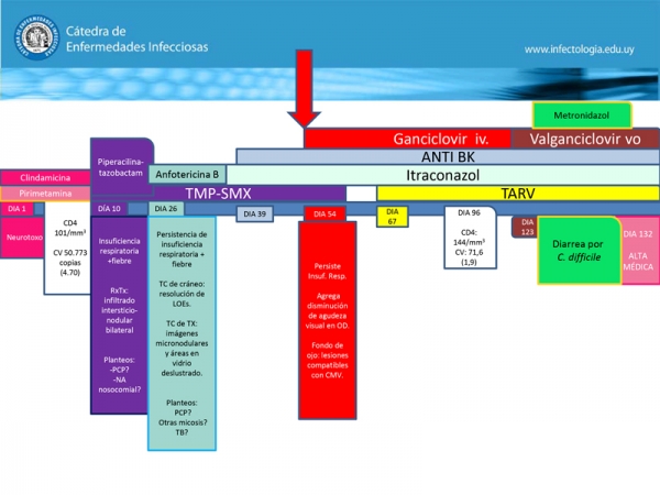 Coriorretinitis por Citomegalovirus en paciente con VIH